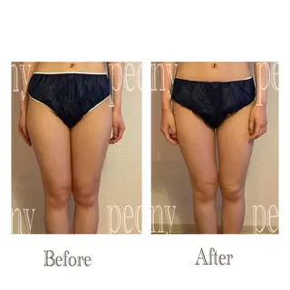 デトックス美容専門サロンpeony所属・デトックス美容専門 サロンpeonyのエステ・リラクイメージ