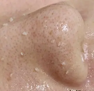 Lien オーナー 山口智嘉のエステ・リラクイメージ