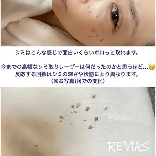 シミケアサロン REVIASオーナーのエステ・リラクイメージ