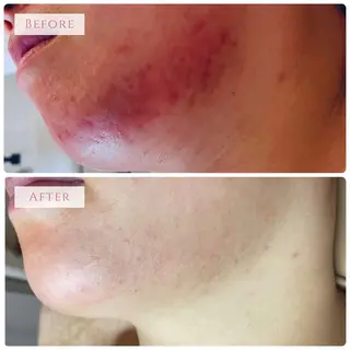 サロンド エルのエステ・リラクイメージ