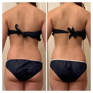 食べながら魅せボディ éclatJua川越のエステ・リラクイメージ