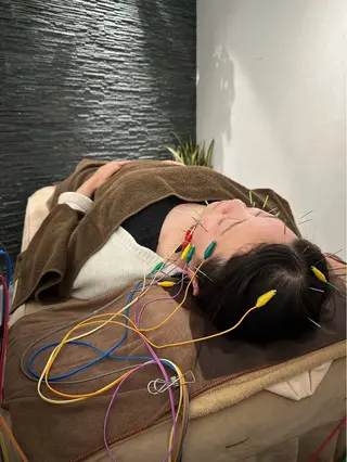 美容鍼灸整体サロンBeauJu所属・小顔/美容鍼専門 BeauJuのその他イメージ