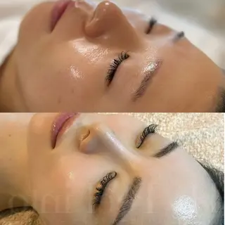 インディバサロン池袋西口所属・mitis+💐 インディバ池袋西口のエステ・リラクイメージ
