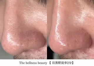 《毛穴レス美肌》ザ・ ベルネス 目黒駅2分のエステ・リラクイメージ