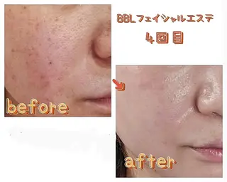 月間600人突破！✨ 渡辺いづみのエステ・リラクイメージ