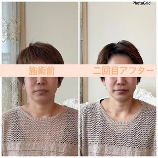 小顔矯正サロン　ReFace Fusae（リフェイスフサエ）所属・小顔矯正サロン リフェイスフサエのエステ・リラクイメージ