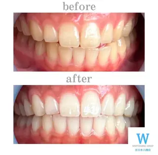 ホワイトニング ショップ本八幡店のエステ・リラクイメージ