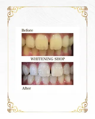 ホワイトニングショップ静岡葵区店所属・ホワイトニング ショップ静岡葵区店のその他イメージ