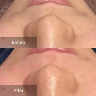 産毛専門店 Bittoのエステ・リラクイメージ