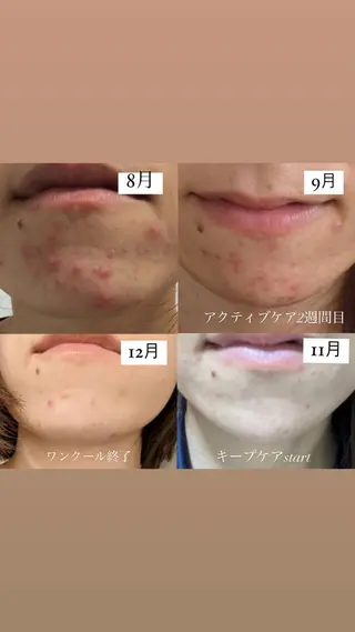 ALIA Scintiller  アリアサンティエ所属・齋藤 祐里耶のエステ・リラクイメージ