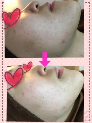 痩身リンパダイエット 隠れ家サロンチャームのエステ・リラクイメージ