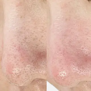 メンズ salonLADYSTYLE所属・稲嶺 美華のエステ・リラクイメージ