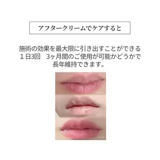 小顔/たるみ/黒ずみ除去専門サロン/SONA 大和西大寺店所属・【小顔専門看護師 サロンSONA】のエステ・リラクイメージ