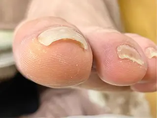 ネイル すこやかネイルサロン　めぐ所属・すこやかネイルサロン めぐのネイルデザイン