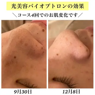 Bellesthe (ベルエステ)のエステ・リラクイメージ