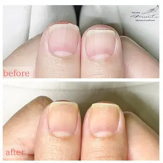 ネイル 深爪・巻き爪 専門サンセリテのネイルデザイン