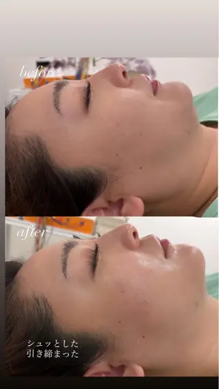 美容鍼灸サロン mahoroba院長のエステ・リラクイメージ