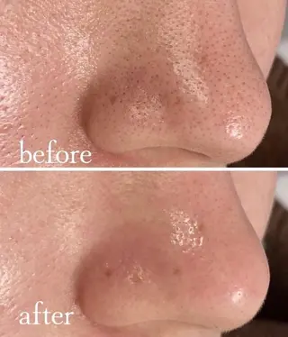 韓国肌管理 【毛穴専科】のエステ・リラクイメージ