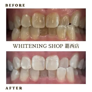 メンズ ホワイトニング ショップ葛西店のその他イメージ
