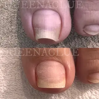 ネイル 毛穴改善/脱毛 ネイル 川上久仁子のエステ・リラクイメージ