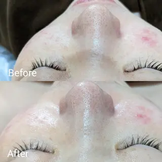 フェイシャルエステ ラトゥール伊深のエステ・リラクイメージ