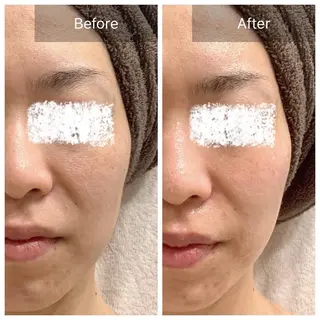 Charis エステ&ネイルのエステ・リラクイメージ