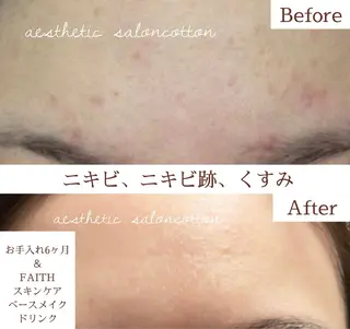 都度払い 肌質改善専門サロンのエステ・リラクイメージ