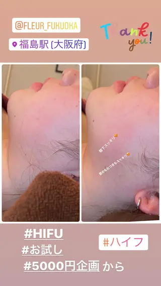 FLEUR大阪・整体 ・ハイフ・痩身・小顔のエステ・リラクイメージ