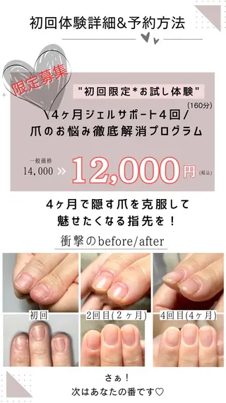 ネイル Aim* 深爪・自爪育成専門店のネイルデザイン