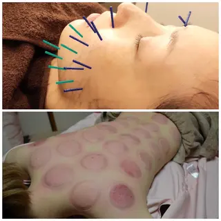 美容鍼灸女性専用 りんご鍼灸治療院のその他イメージ