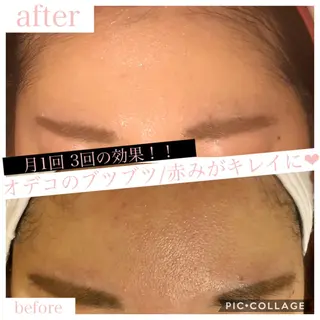 ミディアム カラー パーマ ヘアアレンジ キッズ ネイル マツエク・マツパ Ensor Clair所属・EnsorClair 代表 野口真央のエステ・リラクイメージ