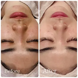 L’Beige レベージュのエステ・リラクイメージ