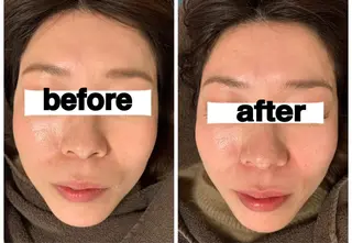 食べながら魅せボディ éclatJua川越のエステ・リラクイメージ