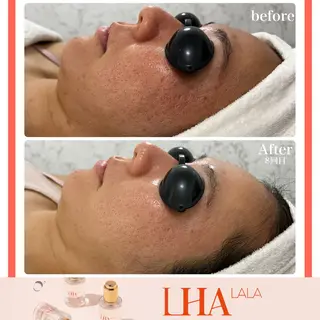 Liam《美肌管理/ 3D小顔/脂肪ケア》のその他イメージ