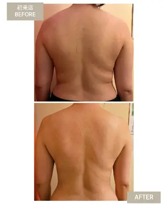 ブロッサム那覇店所属・自分のための筋膜 ﾘﾘｰｽ(Shey)のエステ・リラクイメージ