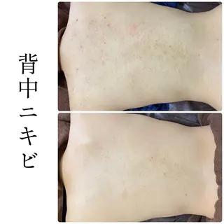 ハーブピーリング専門 BIOEL横浜のエステ・リラクイメージ