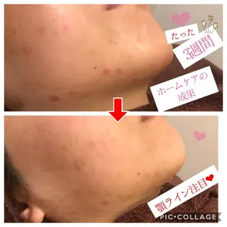 ミディアム カラー パーマ ヘアアレンジ メンズ キッズ ネイル マツエク・マツパ 四つ星サロン🎖 腸＆ニキビケアに特化のエステ・リラクイメージ