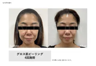 Bellvie beauty salon所属・Bellvie かすみのエステ・リラクイメージ