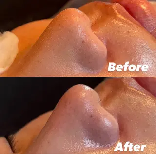 Beauty salon  Liko所属・LIKO フェイシャル&ボディのエステ・リラクイメージ
