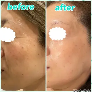 aimer beautyのエステ・リラクイメージ