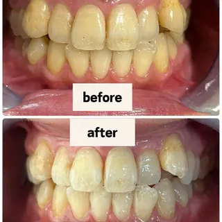 お肌と歯のサロン　Sona Mior所属・藤井 ののみのエステ・リラクイメージ