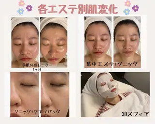 デアイム瀬田所属・高田 穂乃花のエステ・リラクイメージ