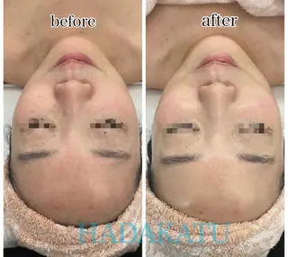 総合エステサロン 肌活のエステ・リラクイメージ