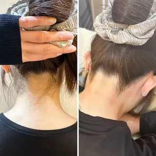 うなじ脱毛/美肌脱毛 LABELのエステ・リラクイメージ