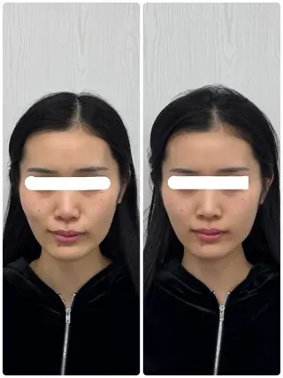 美容鍼×小顔矯正 ×美容整体 浜川泰仁のエステ・リラクイメージ