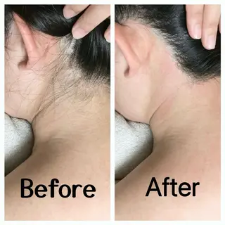 川越ローマピンク 光脱毛＆ワックス脱毛のエステ・リラクイメージ