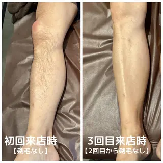 メンズ メンズ脱毛ECXIA所属・men's脱毛サロン ECXIAのエステ・リラクイメージ