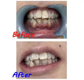 セルフホワイトニングサロン　ラヴィアン所属・ホワイトニングサロン La vie enのその他イメージ