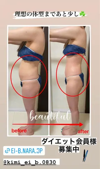 ダイエット／脱毛 美顔／フォト／ハーブのその他イメージ