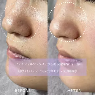 フェイシャルワックス KANAKOのエステ・リラクイメージ